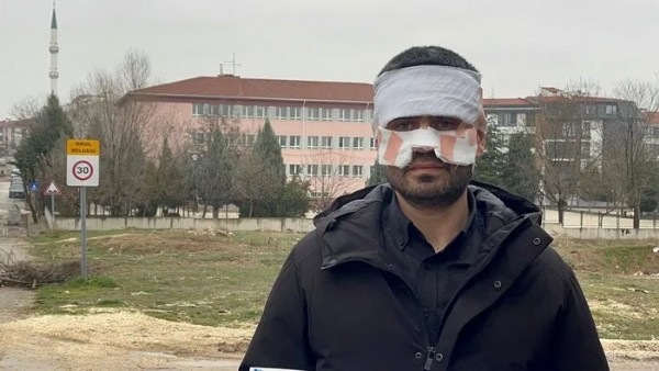 Öğretmenler Odasında 'Sıcak Çay' Dehşeti! Fizik Öğretmeninin Anlattıkları Kan Dondurdu